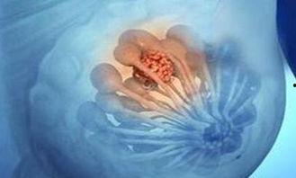 吃瓜小熊乳腺结节,揭秘动物乳腺健康之谜